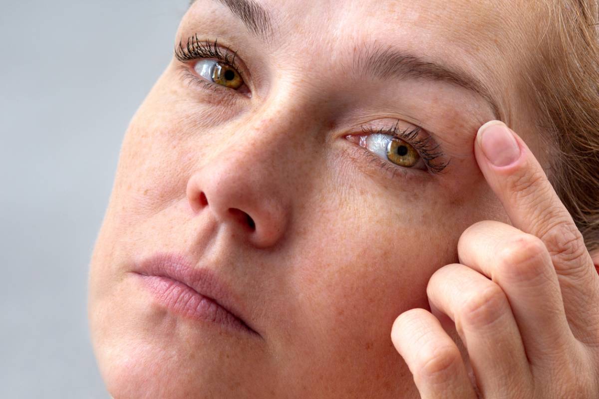 featured image for what causes ptosis